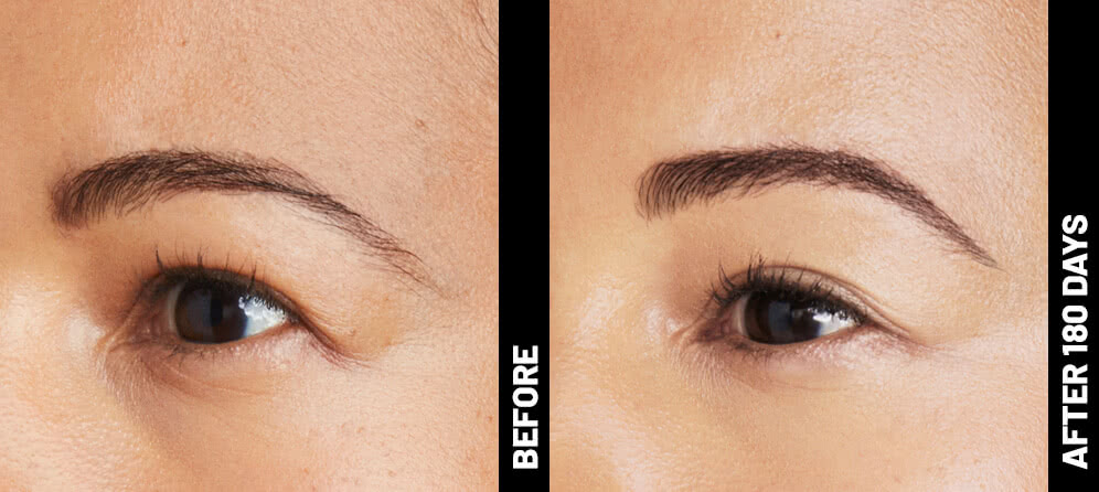 erin, brow results after 180 days