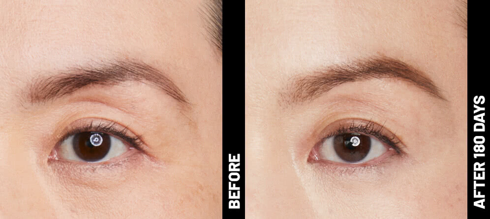 grace, brow results after 180 days