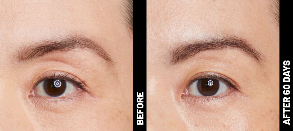 grace, brow results after 60 days