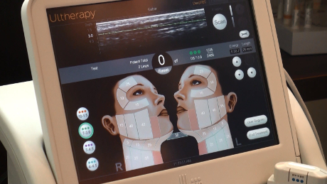 Ultrasound Imaging Ultherapy Device Web
