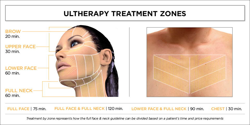 Ultherapy Treatment Zones For The Brow, Chin, Neck and Chest Ultherapy Support