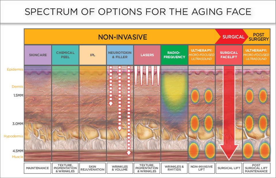 Ultherapy attracts new patients