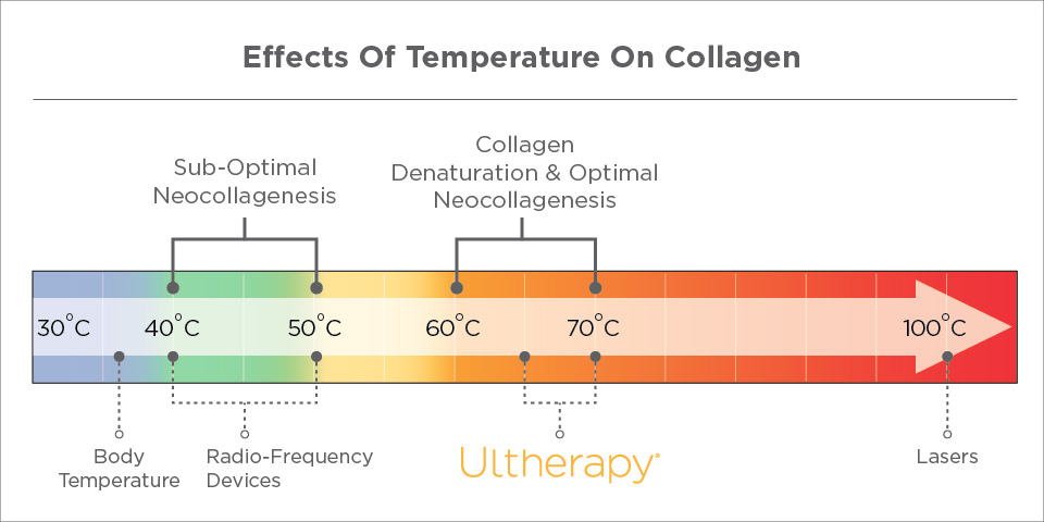 Temperature of Ultherapy Treatment