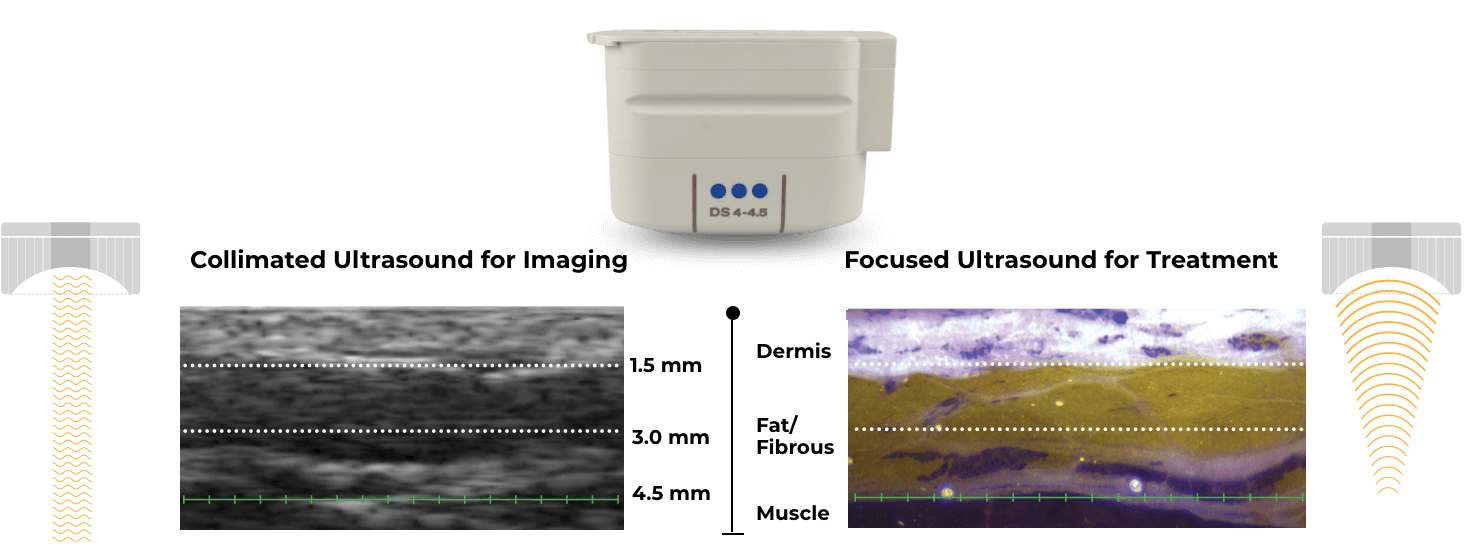 Ultrasound Imaging Illustration